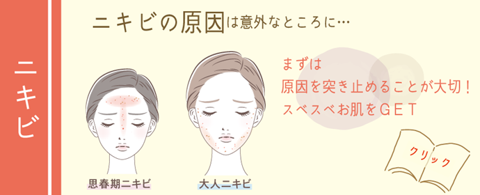 ニキビ
