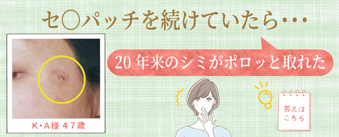 20年来のシミがポロ