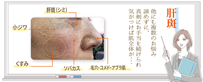 肝斑