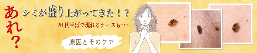 シミ盛り上がり