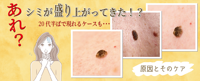 シミ盛り上がり