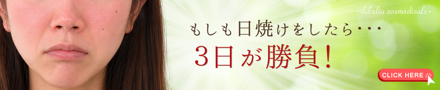 日焼けしたら